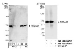 SNW1 Antibody, Novus Biologicals 0.1mL; Unlabeled:Antibodies, Polyclonal