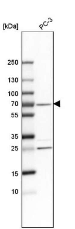 SNW1 Antibody, Novus Biologicals 0.1mL; Unlabeled:Antibodies, Polyclonal