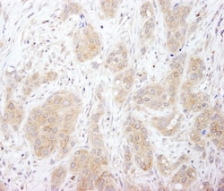 SNX1 Antibody, Novus Biologicals 0.1mL; Unlabeled:Antibodies, Polyclonal