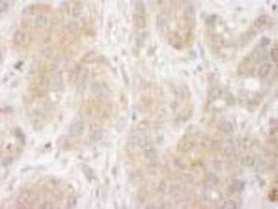 SNX1 Antibody, Novus Biologicals 0.1mL; Unlabeled:Antibodies, Polyclonal