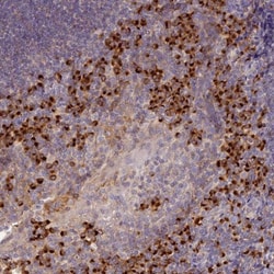 SNX17 Antibody, Novus Biologicals 0.1mL; Unlabeled:Antibodies, Polyclonal