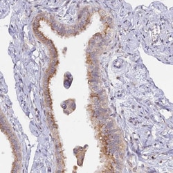 SNX17 Antibody, Novus Biologicals 0.1mL; Unlabeled:Antibodies, Polyclonal