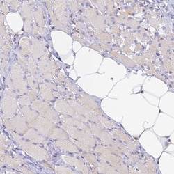 SNX17 Antibody, Novus Biologicals 0.1mL; Unlabeled:Antibodies, Polyclonal