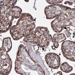 SNX18 Antibody, Novus Biologicals 0.1mL; Unlabeled:Antibodies, Polyclonal