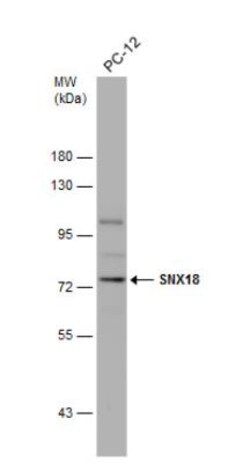 SNX18 Antibody, Novus Biologicals 0.1 mL | Buy Online | Novus Biologicals | Fisher Scientific