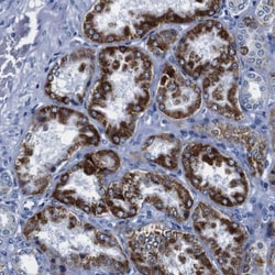 SNX19 Antibody, Novus Biologicals:Antibodies:Primary Antibodies
