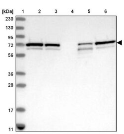 SNX2 Antibody, Novus Biologicals 25 &mu;L | Buy Online | Novus Biologicals | Fisher Scientific