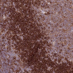 SNX21 Antibody, Novus Biologicals 0.1mL; Unlabeled:Antibodies, Polyclonal
