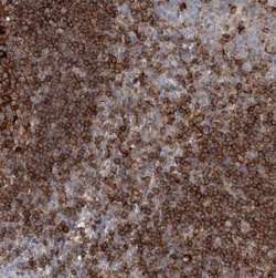 SNX22 Antibody, Novus Biologicals 0.1mL; Unlabeled:Antibodies, Polyclonal