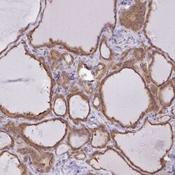 SNX5 Antibody, Novus Biologicals:Antibodies:Primary Antibodies