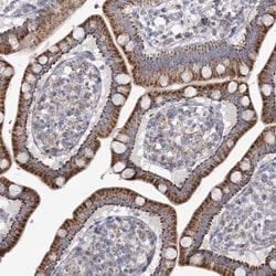 SNX7 Antibody, Novus Biologicals 25 &mu;L; Unlabeled:Antibodies, Polyclonal