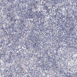 SNX7 Antibody, Novus Biologicals 25 &mu;L; Unlabeled:Antibodies, Polyclonal