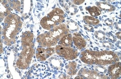 SOCS-1 Antibody, Novus Biologicals 100 ul; Unconjugated:Antibodies, Polyclonal