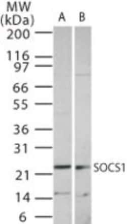 SOCS-1 Antibody, Novus Biologicals:Antibodies:Primary Antibodies