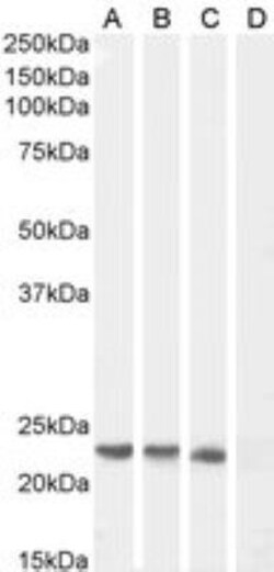 SOCS-1 Antibody, Novus Biologicals 0.1mg; Unlabeled:Antibodies, Polyclonal