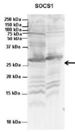 SOCS-1 Antibody, Novus Biologicals 100 ul; Unconjugated:Antibodies, Polyclonal