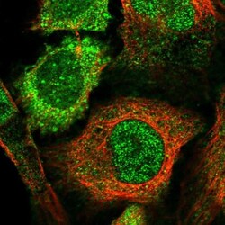 SOCS-5 Antibody, Novus Biologicals:Antibodies:Primary Antibodies