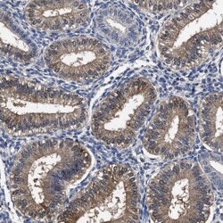 SOCS-5 Antibody, Novus Biologicals:Antibodies:Primary Antibodies