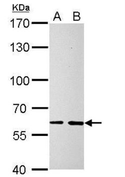 SOCS-5 Antibody, Novus Biologicals 0.1mg; Unlabeled:Antibodies, Polyclonal