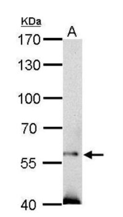 SOCS-5 Antibody, Novus Biologicals 0.1mg; Unlabeled:Antibodies, Polyclonal
