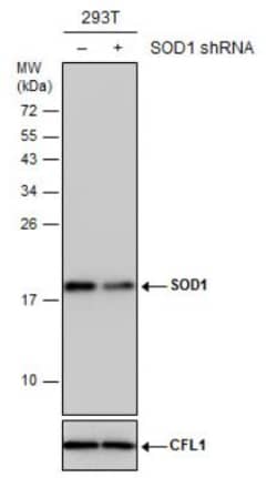 SOD1/Cu-Zn SOD Antibody, Novus Biologicals 0.1mL; Unlabeled:Antikroppar