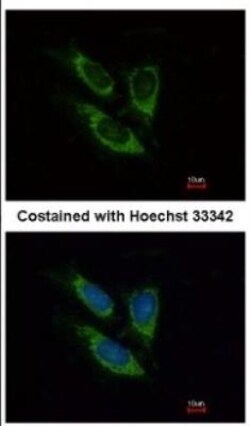 SOD2/Mn-SOD Antibody, Novus Biologicals 0.1mL; Unlabeled:Antibodies, Polyclonal