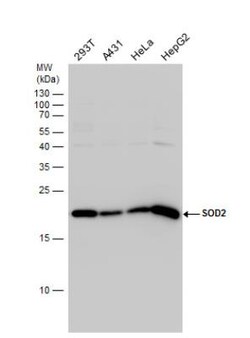SOD2/Mn-SOD Antibody, Novus Biologicals 0.1mL; Unlabeled:Antibodies, Polyclonal