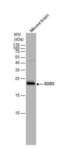 SOD2/Mn-SOD Antibody, Novus Biologicals 0.1mL; Unlabeled:Antibodies, Polyclonal
