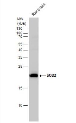 SOD2/Mn-SOD Antibody, Novus Biologicals 0.1mL; Unlabeled:Antibodies, Polyclonal