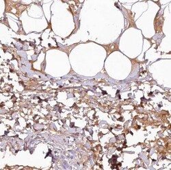 SOD3/EC-SOD Antibody, Novus Biologicals 0.1mL; Unlabeled:Antibodies, Polyclonal