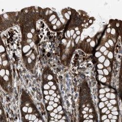 RBP4/Retinol-Binding Protein 4 Antibody, Novus Biologicals:Antibodies:Primary