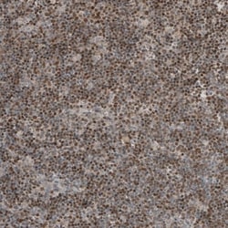 SOX11 Antibody, Novus Biologicals 25 &mu;L | Buy Online | Novus Biologicals | Fisher Scientific