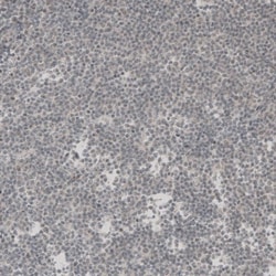 SOX11 Antibody, Novus Biologicals 25 &mu;L | Buy Online | Novus Biologicals | Fisher Scientific