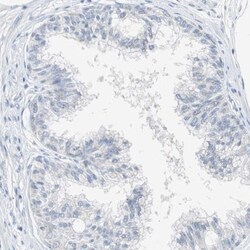 SOCS-5 Antibody, Novus Biologicals:Antibodies:Primary Antibodies
