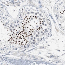 SOCS-5 Antibody, Novus Biologicals:Antibodies:Primary Antibodies