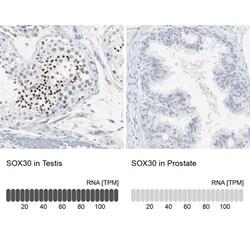 SOCS-5 Antibody, Novus Biologicals:Antibodies:Primary Antibodies