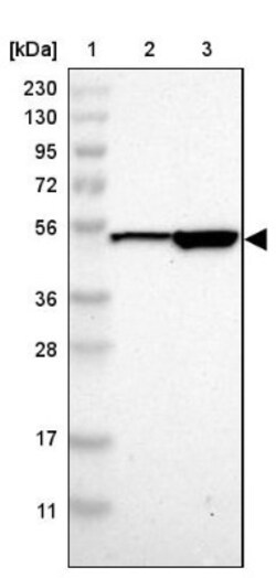 SOCS-5 Antibody, Novus Biologicals:Antibodies:Primary Antibodies