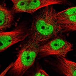 SOX4 Antibody, Novus Biologicals:Antibodies:Primary Antibodies