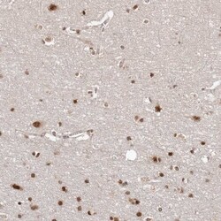 SOX4 Antibody, Novus Biologicals:Antibodies:Primary Antibodies