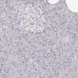 SOX4 Antibody, Novus Biologicals:Antibodies:Primary Antibodies