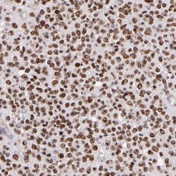 SOX6 Antibody, Novus Biologicals:Antibodies:Primary Antibodies