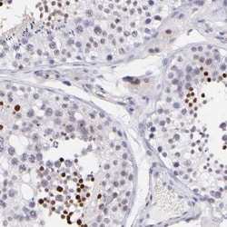 SOX6 Antibody, Novus Biologicals:Antibodies:Primary Antibodies