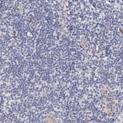 SOX6 Antibody, Novus Biologicals:Antibodies:Primary Antibodies