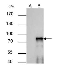 SOX6 Antibody, Novus Biologicals 0.1 mL | Buy Online | Novus Biologicals | Fisher Scientific