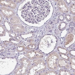 SP-B/Surfactant Protein B Antibody, Novus Biologicals 0.1mL; Unlabeled:Antibodies,