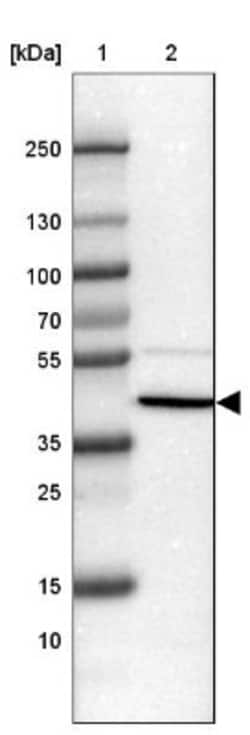 SP-D Antibody, Novus Biologicals 0.1mL; Unlabeled:Antibodies, Polyclonal
