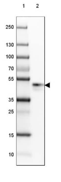 SP-D Antibody, Novus Biologicals 0.1mL; Unlabeled:Antibodies, Polyclonal