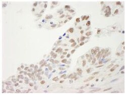 SP1 Antibody, Novus Biologicals 0.1mg; Unlabeled:Antibodies, Polyclonal