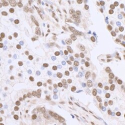 SP1 Antibody, Novus Biologicals 0.1mg; Unlabeled:Antibodies, Polyclonal