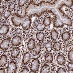 SP1 Antibody, Novus Biologicals 0.1mL; Unlabeled:Antibodies, Polyclonal
